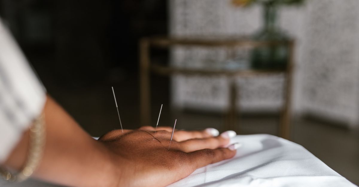 découvrez tout sur l'aiguille : outils, utilisations et conseils pratiques pour la couture et bien plus.