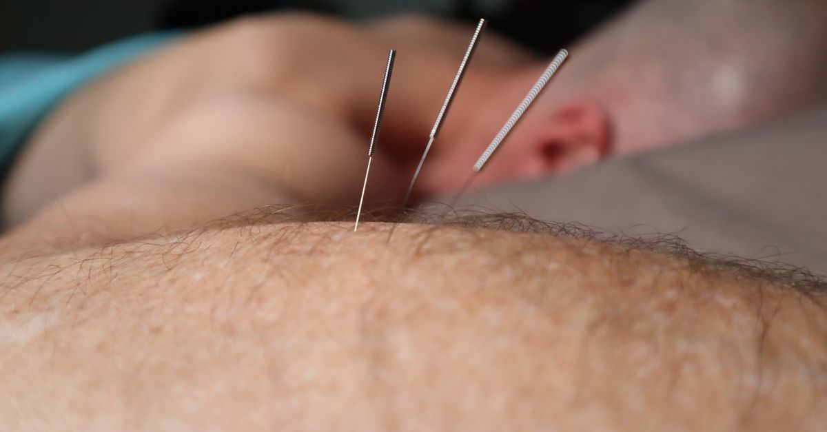 découvrez tout sur l'aiguille : son utilisation, ses types et conseils pour choisir la meilleure aiguille adaptée à vos besoins en couture, tricot ou médecine.